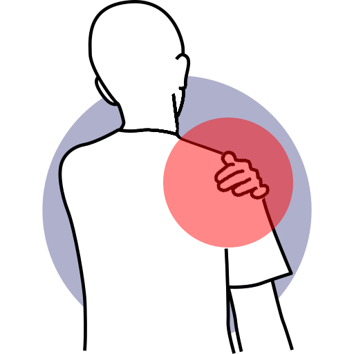 Rotator Cuff Pain